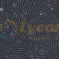 人微血管内皮细胞株；HMEC-1(STR)