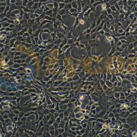 小鼠乳腺癌细胞带荧光素酶;4T1/LUC(种属鉴定)