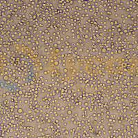 人浆细胞白血病；ARH-77(STR)