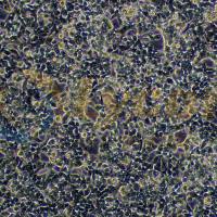 人鼻咽癌细胞;C666-1(STR)