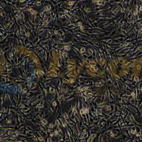 大鼠神经胶质瘤细胞；C6