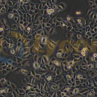 人鼻咽癌细胞；NPC/HK-1(STR)