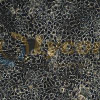 人肝癌细胞；HuH-7(STR)