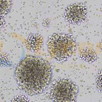 人恶性非霍奇金淋巴瘤患者的自然杀伤细胞;NK-92MI(STR)