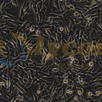 人恶性黑色素瘤细胞;WM-115(STR)