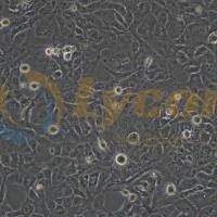 人肝星形细胞；LX-2(STR)