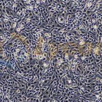 大鼠肾上腺嗜铬细胞瘤细胞(高分化);PC-12(高分化)