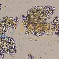 人小细胞肺癌细胞;NCI-H69(STR)