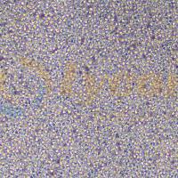 人急性非B非T淋巴细胞性白血病细胞;Reh(STR)