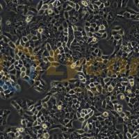 人肺腺癌细胞;SPC-A-1(STR hela交叉污染)