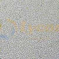 人骨髓瘤细胞；U266(STR)