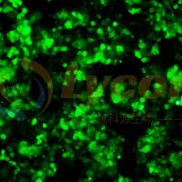 人肝癌细胞带绿色荧光;HepG2/GFP