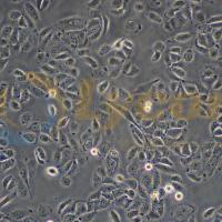 人膀胱癌细胞带荧光素酶;5637/LUC(STR)