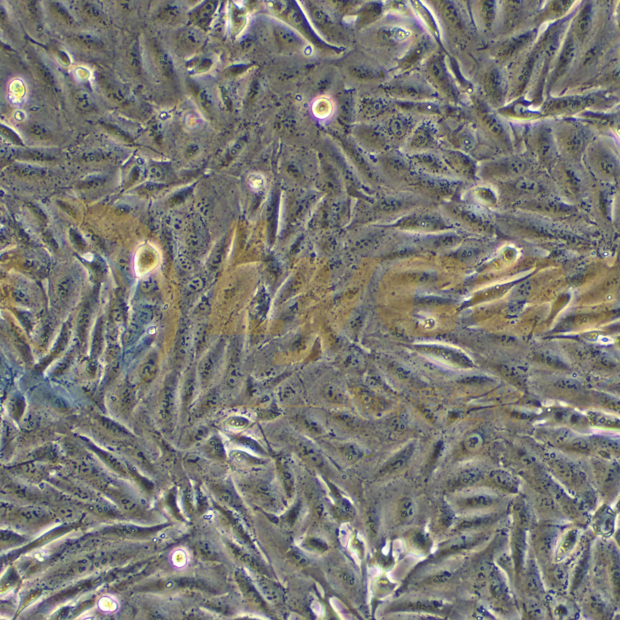 人黑色素瘤细胞;A875(STR)
