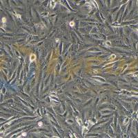 人黑色素瘤细胞;A875(STR)