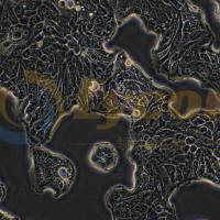 人肺腺癌细胞;Calu-3(STR)
