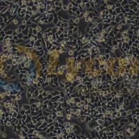 人结肠癌细胞;HCT-15(STR)