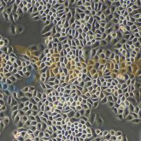 人宫颈癌细胞;Hela(STR)