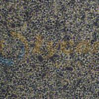 小鼠睾丸畸胎瘤细胞;P19(种属鉴定)