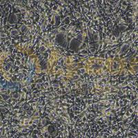 小鼠结肠癌细胞;CT-26(种属鉴定)