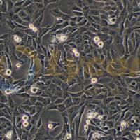 人骨肉瘤细胞;143B(STR)