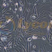 人甲状腺癌细胞;FTC-133(STR)