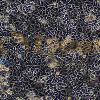 人结肠癌细胞；Caco2(STR)