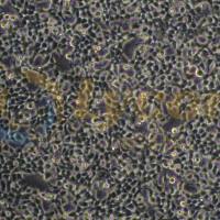 SV40T转化的人胚肾细胞；293T(STR)