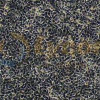 鸡肝癌细胞；LMH[ATCC CRL-2117]