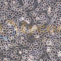 人肺腺癌细胞吉非替尼耐药株;PC-9GR(PC-9吉非替尼耐药)(STR)