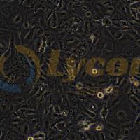 人鼻咽癌细胞株;5-8F(STR)