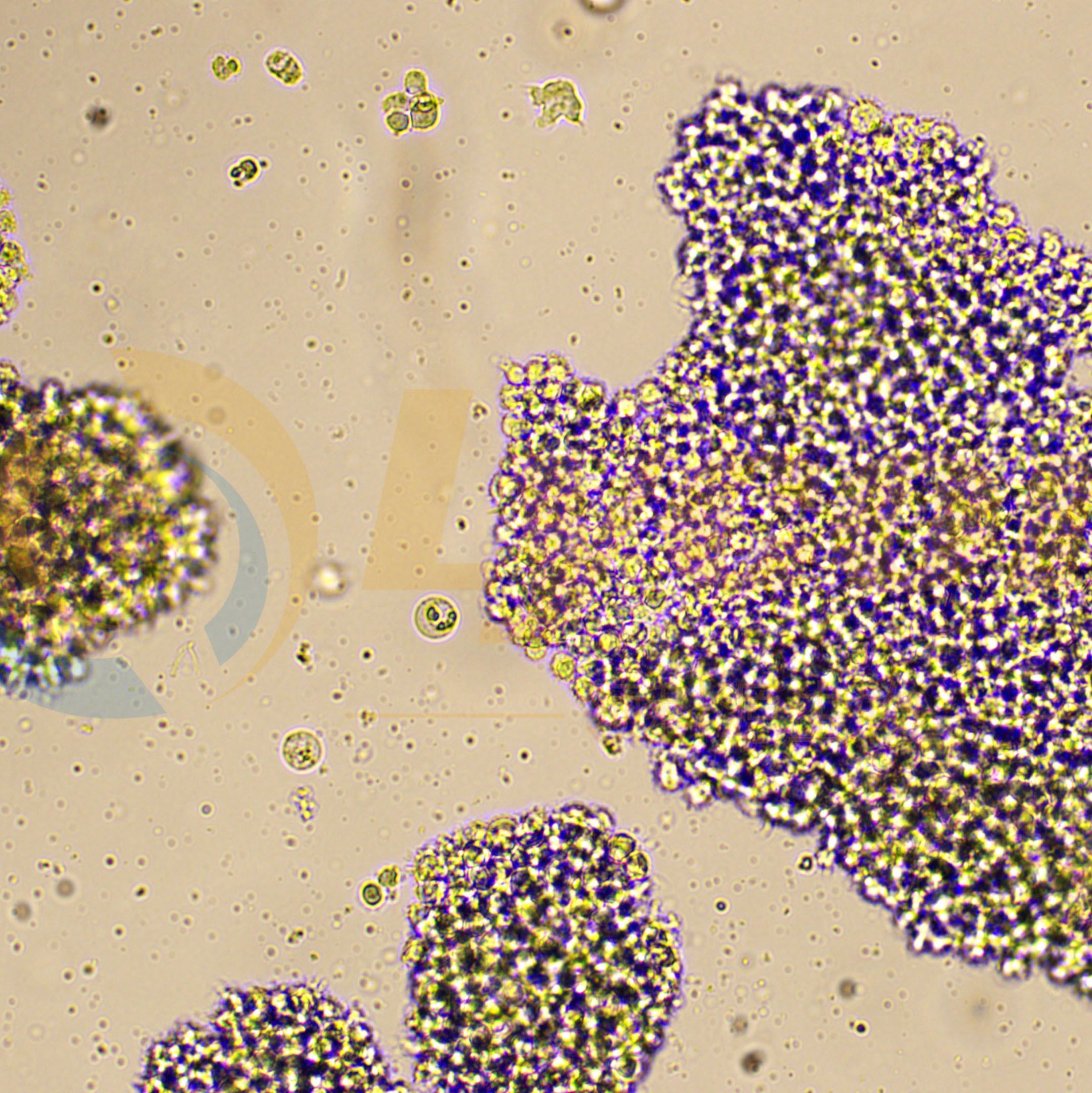 人T淋巴细胞白血病细胞；C8166-CD4(STR)