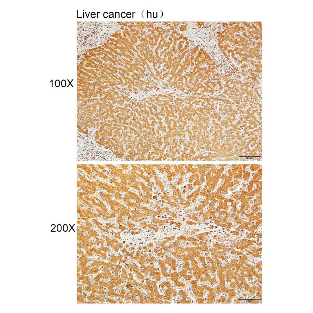 Anti-KIAA0408 Polyclonal Antibody-实验图片