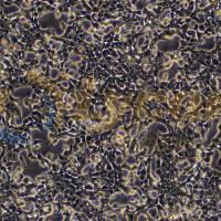 大鼠胰岛细胞瘤细胞;INS-1