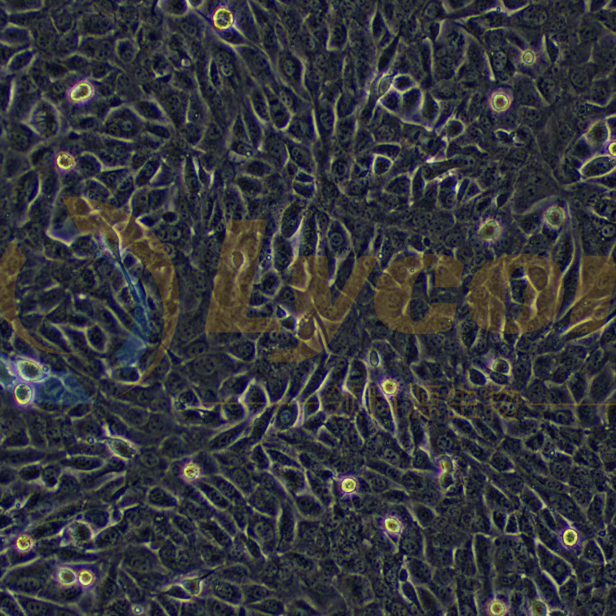 小鼠卵巢癌细胞;ID8(种属鉴定)