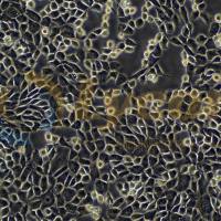 小鼠海马神经元细胞系；HT22（种属鉴定）