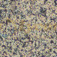 小鼠肺癌细胞;LLC(种属鉴定)