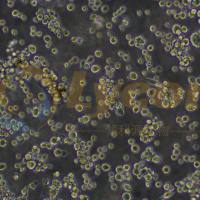 中国仓鼠卵巢细胞；CHO