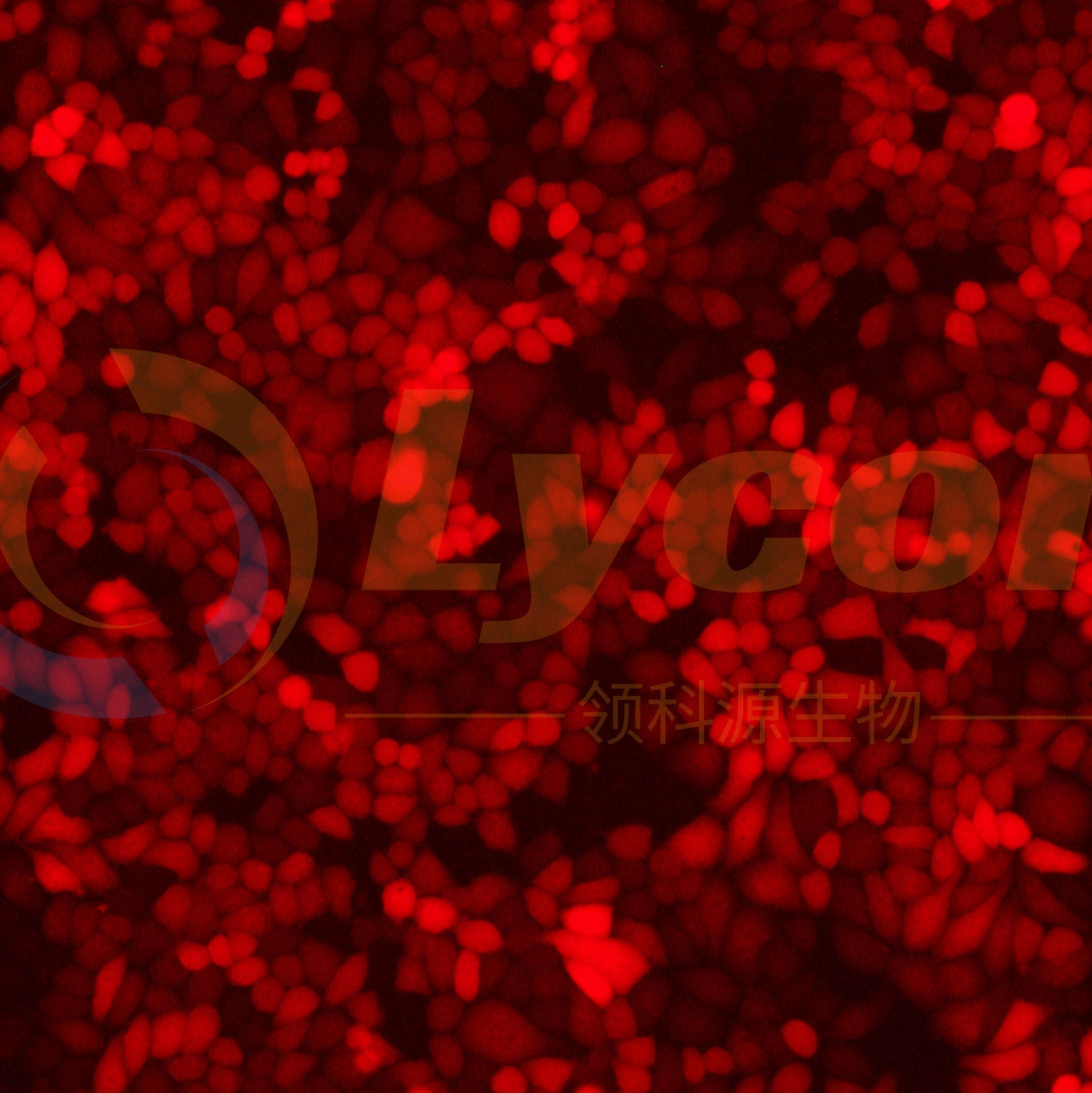 人宫颈癌细胞带红色荧光;HELA/RFP