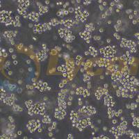 人EBV转化淋巴细胞系;Akata(STR)