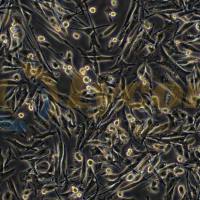 人恶性黑色素瘤细胞;SK-MEL-28(STR)