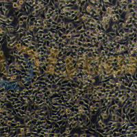 人结肠癌细胞(低分化);RKO(STR)