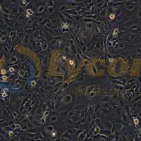 人膀胱上皮永生化细胞;SV-HUC-1(STR)