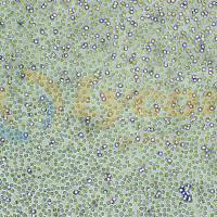 人B淋巴细胞瘤细胞;RAMOS(STR)