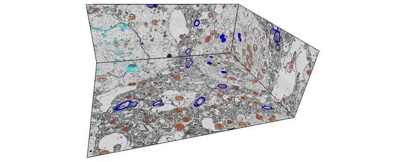 死亡后脑组织的 3D 成像，解密认知功能的纳米级奥秘
