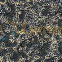 人胶质母细胞瘤细胞；A172(STR)