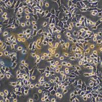 大鼠肝癌细胞;RH-35