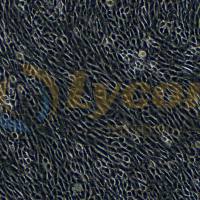 正常大鼠肾细胞（EGF受体阳性）；NRK-49F