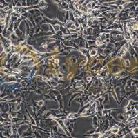 人恶性胚胎横纹肌瘤细胞；RD(STR)