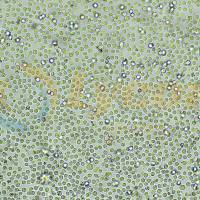 人B细胞淋巴瘤；SU-DHL-4(STR)